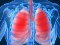 Kétoldalú tüdőgyulladás tüdőgyulladás tünetei és kezelése
