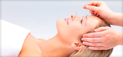 Akupunktúra fogyás módszerek, az akupunktúrás pontokat, az előnyöket és a hátrányokat (kb akupunktúra vélemény)