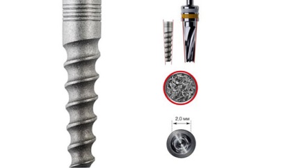 Implantátumok alfa Dent - konstruktív jellemzői, előnyei, árai implantátum alfa Dent - (Dent) Alpha Dent implantátumok - tervezési jellemzőit, előnyeit, az árak implantátumok alfa dent -