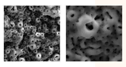 Az implantátumok alfa dent - konstruktív jellemzői, előnyei, az árak implantátum alfa dent - (funkciók) Alpha Dent implantátumok - tervezési jellemzőit, előnyeit, az árak implantátumok alfa dent -