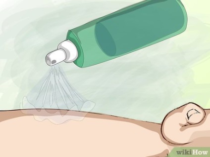 Hogyan kerüljük el a szúnyogcsípés (szúnyogok)