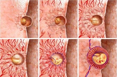 Hogyan lehet megkülönböztetni toxémia (terhesség) származó mérgezett