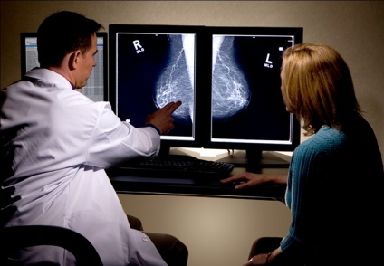 Ha kell tennie a mammográfia milyen korban és milyen gyakran kell szűrni