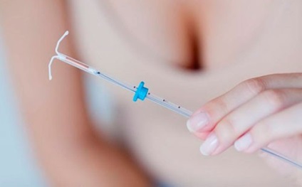 Fogamzásgátlók és a tabletta a szoptatás alatt