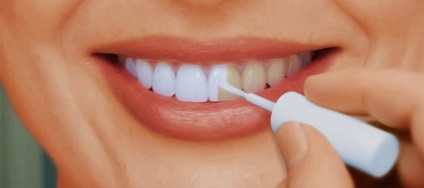 Nail fogak előnyei és hátrányai használati utasítás