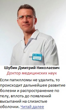 John Kronstadt Ima megszabadítás és a gyógyítás az alkoholizmus - ortodox ikonok és ima (János) John Kronstadt Ima megszabadítás és gyógyító alkoholizmus - ortodox ikonok és ima
