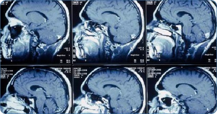 MRI a fej és az agy Moszkva, árak, vélemények és címek