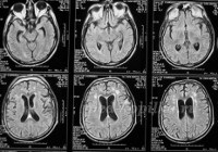 MRI az agy - az árak Moszkvában talált 280 árak