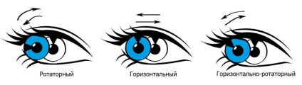 Nystagmus szemre, okai, típusai, diagnózis és kezelés (faj) Nystagmus szemre, okai, típusai, diagnózis és kezelés
