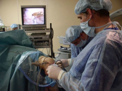 Műtét a térd meniscus, videók és vélemények, műtét utáni gyógyulási idő