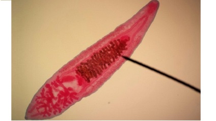 Opisthorchiasis parazita fotó néz ki, mint egy ember Opisthorchis