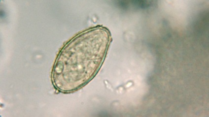 Opisthorchiasis parazita fotó néz ki, mint egy ember Opisthorchis