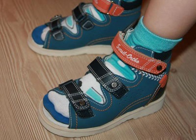 Ortopéd cipők gyermekek valgus deformitás