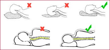 Ortopéd párnák, hogyan kell választani