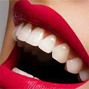 Tooth Whitening hidrogén-peroxiddal