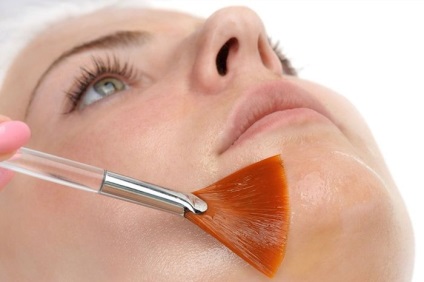 Peeling arcvonások kozmetikai kezelések otthon