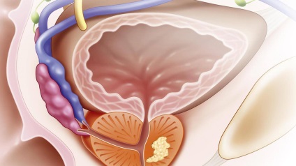 Előnyök és árt a prosztata masszázs