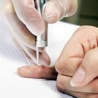 Shipitsa az ujját, a kezelés és az oka annak megjelenését