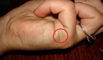 Ülök az anyám a kórházban, a lé! (SIT) Ülök az anyám a kórházban, a lé!