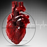 Egy tipikus formája a szívinfarktus - mi ez, diagnosztika, időszakok