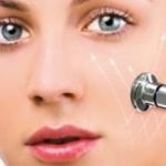 Ellátás után kémiai hámlasztás köze a bőr a kezelés után közepes vagy mély