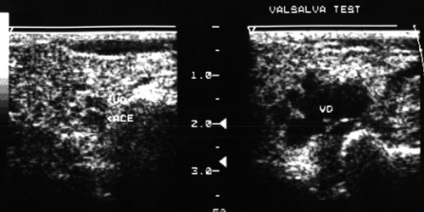 Uzi maxillofacial - és Nadtochy