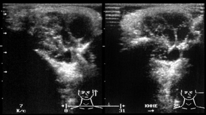 Uzi maxillofacial - és Nadtochy