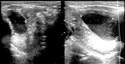 Uzi maxillofacial - és Nadtochy