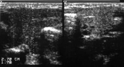 Uzi maxillofacial - és Nadtochy