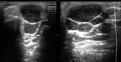 Uzi maxillofacial - és Nadtochy