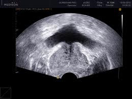 Ultrahang Urológia