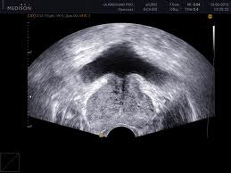 Uzi Urology (urológia) Ultrahang Urológia