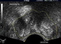 Uzi Urology (urológia) Ultrahang Urológia