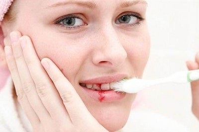 Idült fogínygyulladás okoz, tünetek és a kezelés