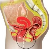 Aloe ha hüvelyi gyulladások - szike - orvosi portál (vaginális) Aloe hüvelyi gyulladás - szike - orvosi információk és oktatási portál