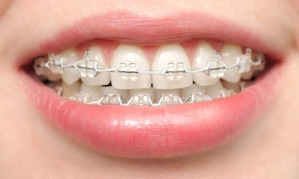 Dental Salon „- a mosoly - munkánk