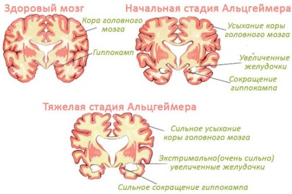 Diagnosztizálása agyi betegségek 1