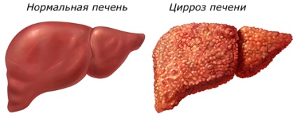 lép - nyirokrendszer - a belső szervek és rendszerek - humán anatomiya