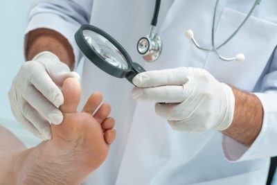 Gombák lábai között kezelés gyógyszerek ujjaival népi jogorvoslati otthon