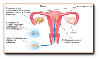 Beültetése egy három napos embrió (videó)