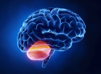 A stroke az agy kisagyi tünetek és hatások előrejelzése