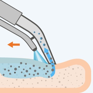 Hogyan visszavonja a vért a matrac, és távolítsa el a régi foltokat környezetbarát tisztítószerek