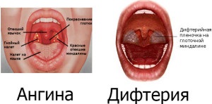 Lehetséges, hogy öblítse ki a száját hidrogén-peroxid - hogyan szaporodnak a gyógyszer helyes