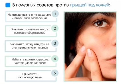 Akne egy bőr - okok és azok eltávolítását (acne) Akne egy bőr - az okok és hogyan lehet eltávolítani őket