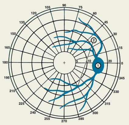 Scotoma tünetei, diagnosztikai módszerek, a betegség