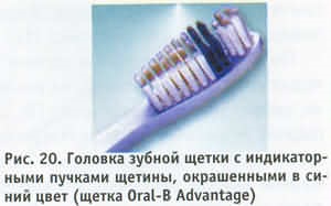 A szerkezet a modern fogkefék
