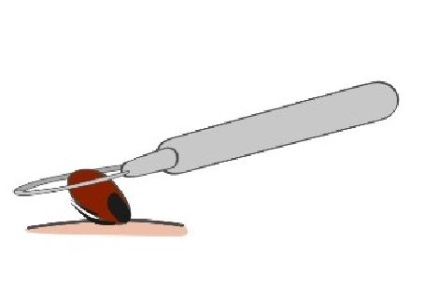 Kullancscsípésre - mit tesz egy blog - elsősegély tanfolyamok (tick-eltávolító eszköz) Kullancscsípésre - mit tesz a blog - természetesen a elsősegély