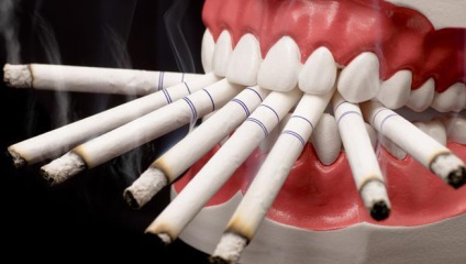 A hatás a dohányzás a fogak, mint a cigaretta befolyásolják az emberi fogak