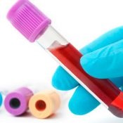 Prosztata adenoma diagnózis és tünetek (prosztata) Prosztata adenoma diagnózis és tünetek