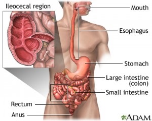 Crohn-betegség